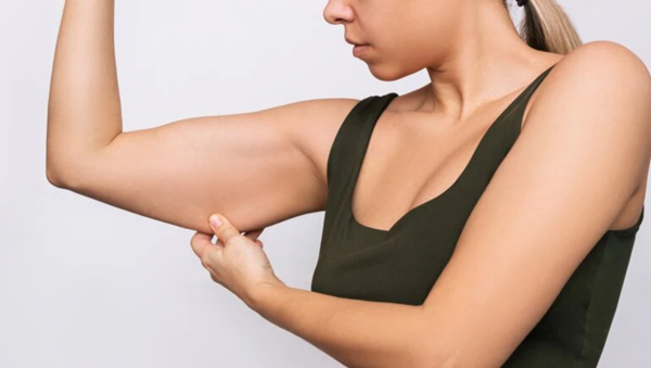 Arm liposuction side effects