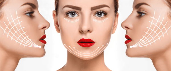 facelift surgery