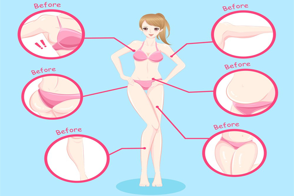 Best Liposuction Clinics