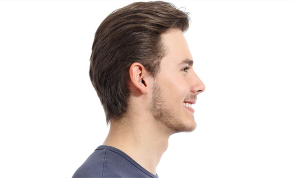 Male Rhinoplasty