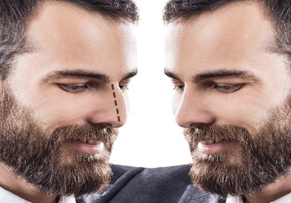 Best Place for Male Rhinoplasty