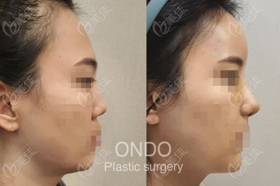 ONDO Plastic Surgery