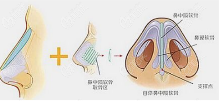 Reconstruction Surgery Case