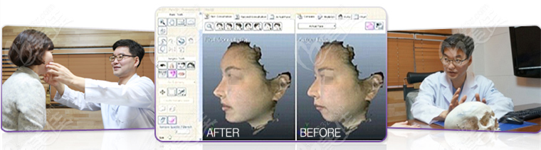 Advantages of Dr. Kim Byung-geon's Rhinoplasty