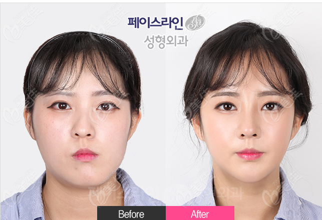 Faceline Plastic Surgery