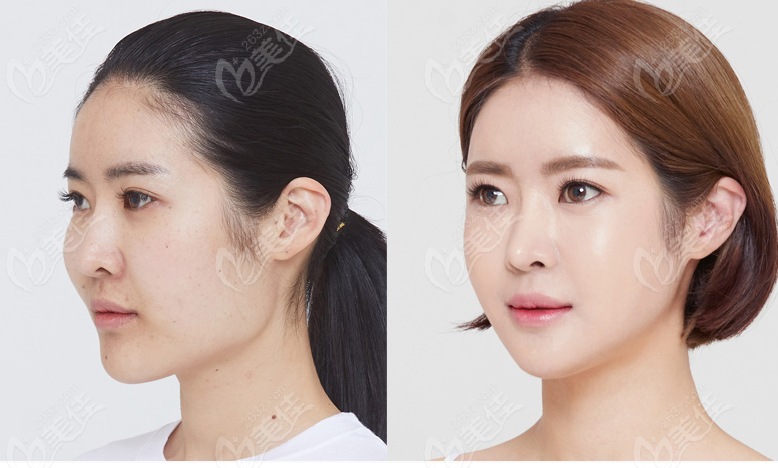 Imageup Plastic Surgery