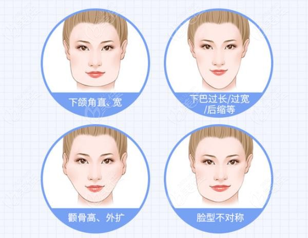 What about Dr. Lin Zongyu's Cheekbone Reduction Technique ? 