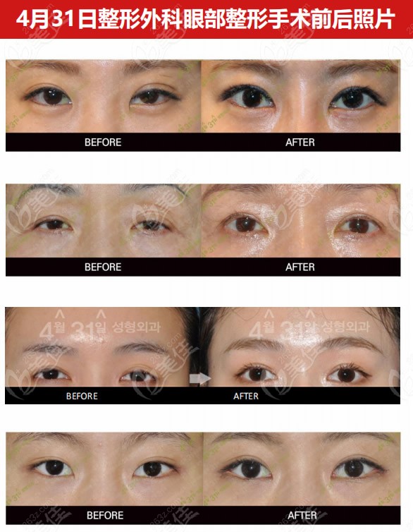 Compilation of eye repair photos from 431 Plastic Surgery