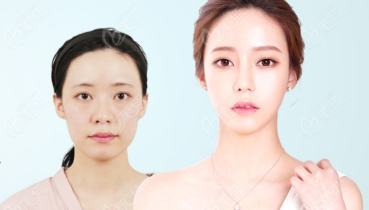 facial contouring surgery facial contouring surgery