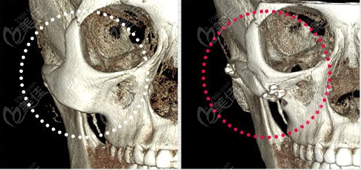 top 10 surgeons for contouring surgery