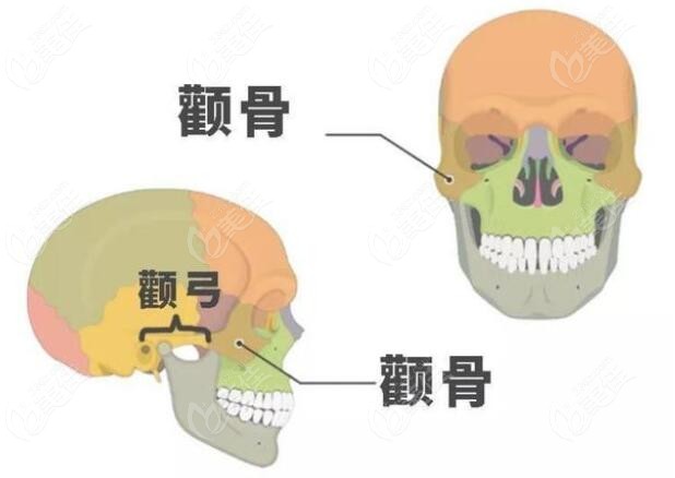 韩国颧骨内推手术价格多少钱？4万+