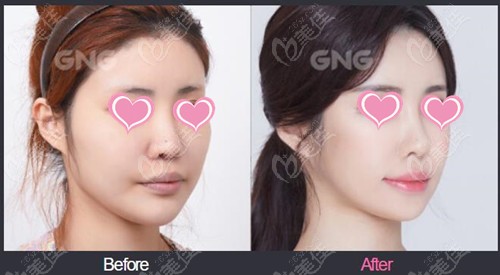 Contour Style by GNG Plastic Surgery