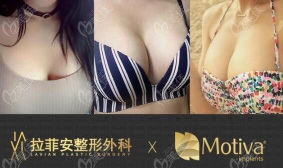 breast augmentation