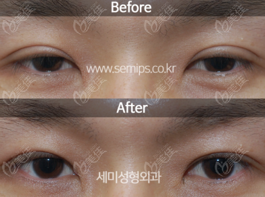 examples of eye repairs done by Director Park
