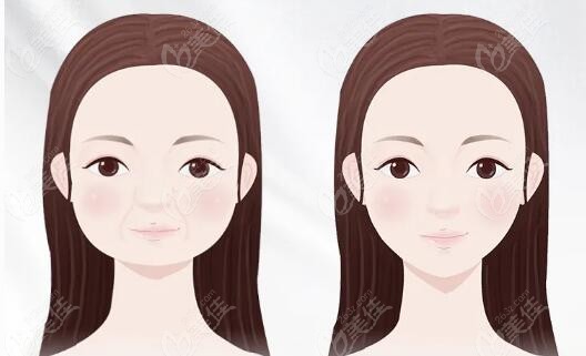 Examples of Cooki Plastic Surgery's contouring results